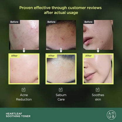 ANUA HEARTLEAF +77 SOOTHING TONER 100ml